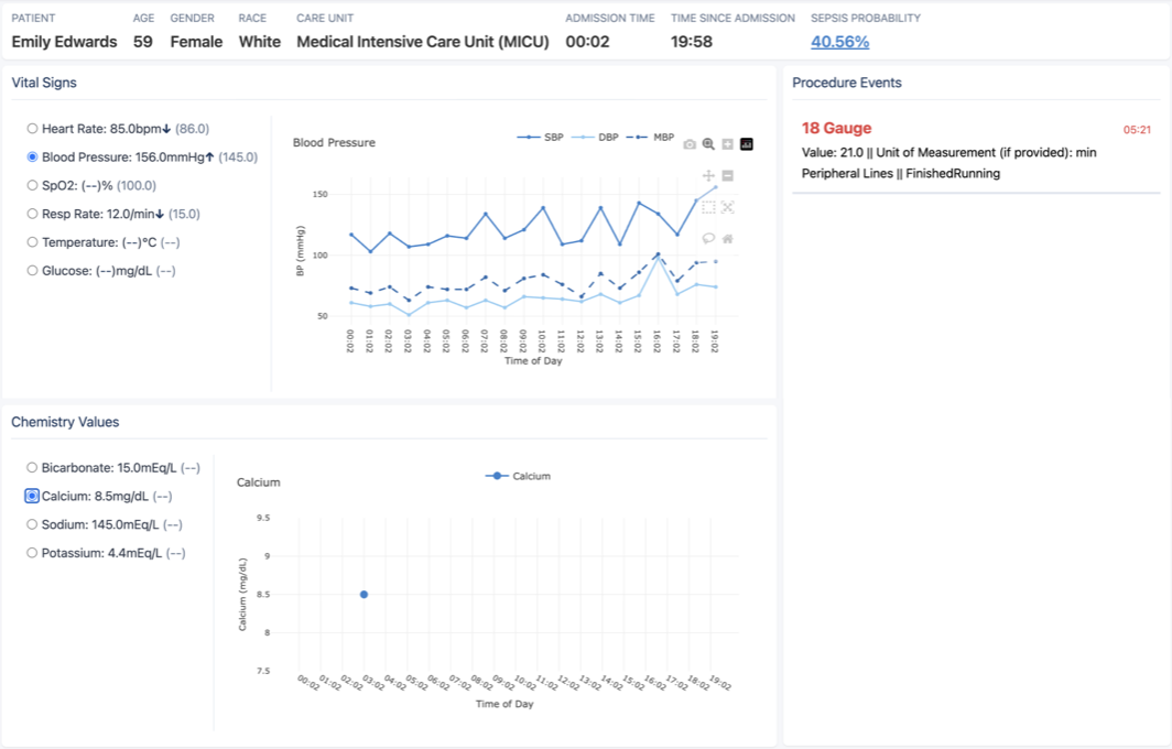 ICU Sepsis Decision Support